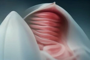 Alimentation entérale et soins spécifiques après une lourde chirurgie